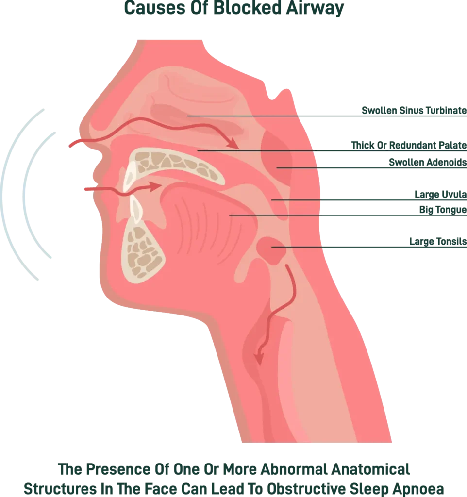 Difficulty Breathing infographic