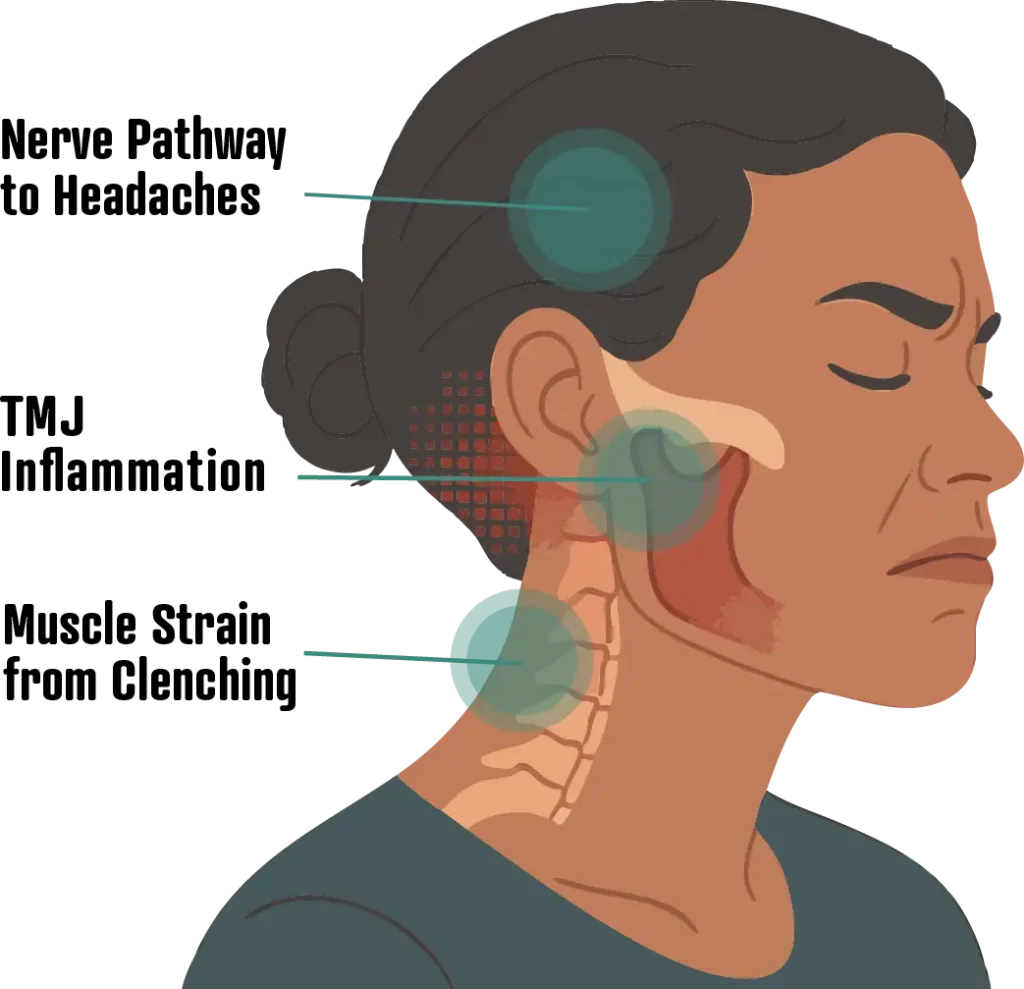 Migraines infographic