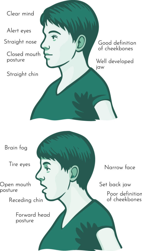 Myofunctional-Infographic
