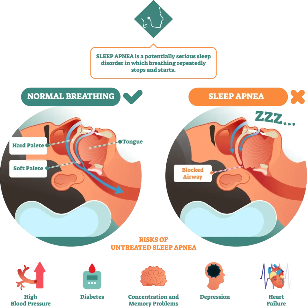 Snoring infographic
