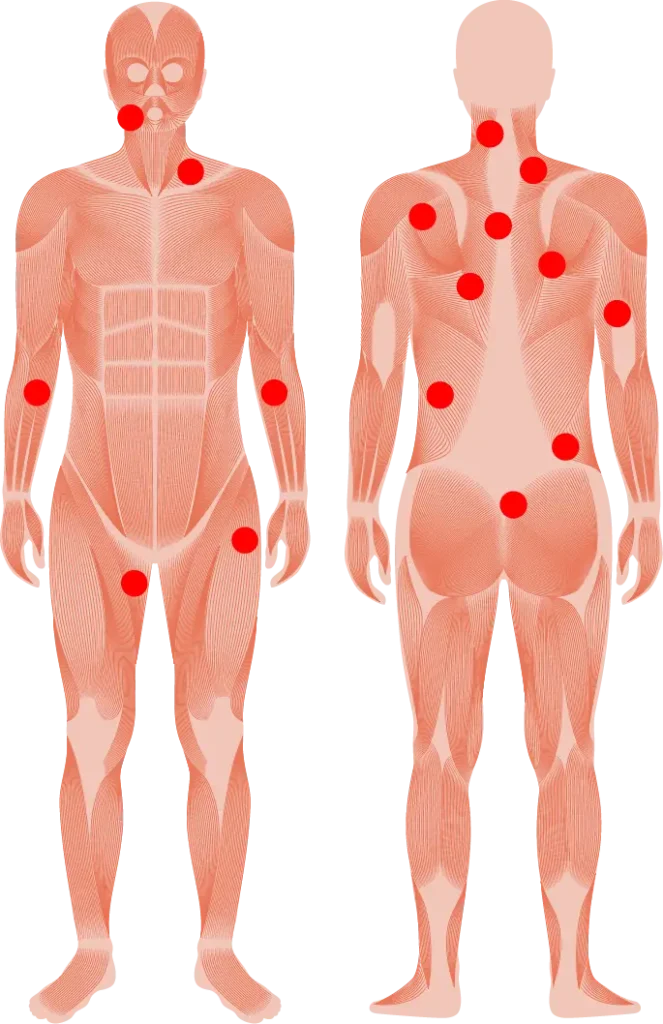Trigger Point Therapy