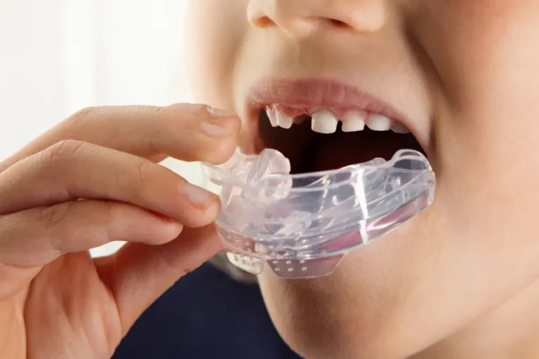 Silicone myobraces for habit correction
