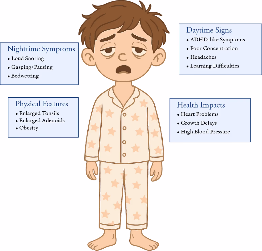Signs of pediatric sleep apnea Illustration of a tired child in pajamas labeled with pediatric sleep apnea signs: nighttime snoring, gasping and bedwetting; enlarged tonsils and adenoids; ADHD-like daytime symptoms and poor concentration; and health impacts including growth delays